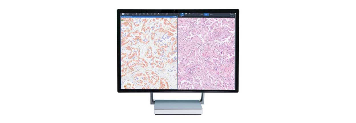 Roche uPath PD-L1(SP263) 画像解析 (NSCLC用) | ロシュ・ダイアグノスティックス