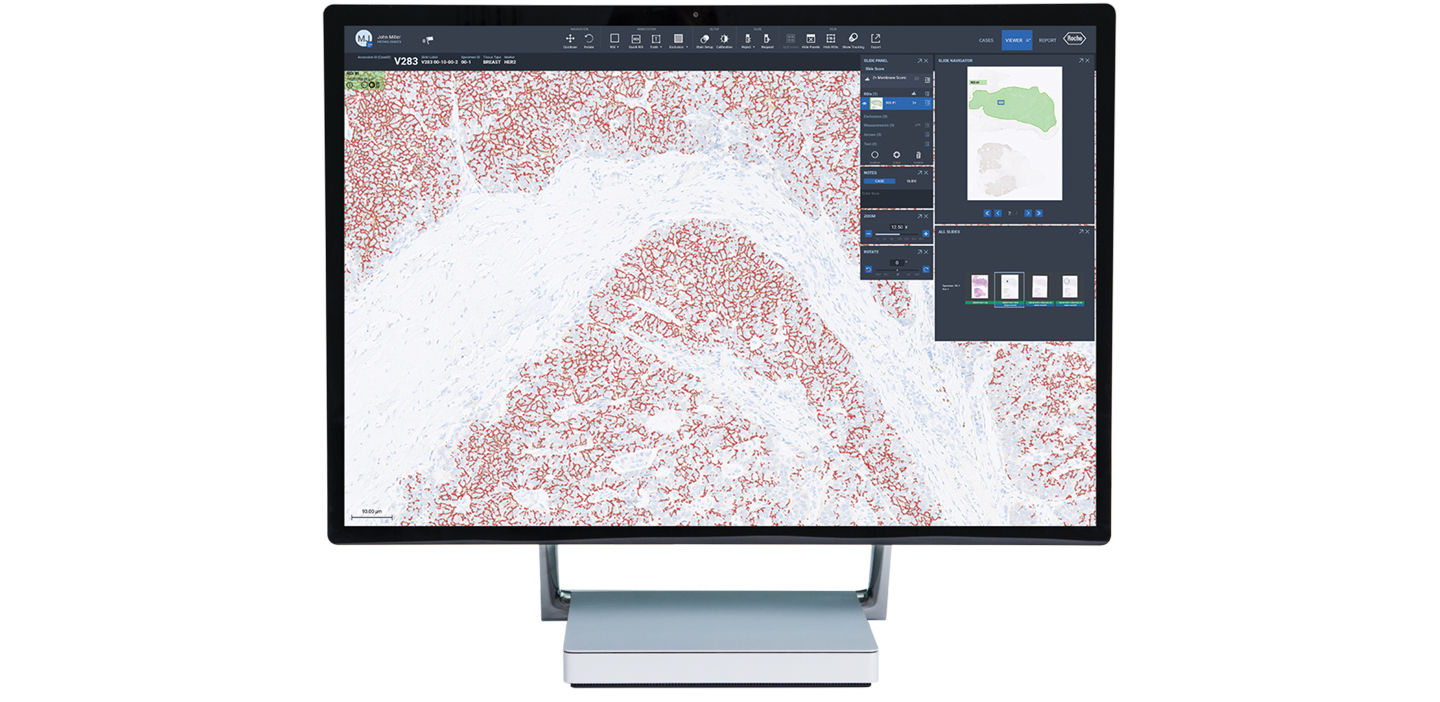 Produit pour l’analyse d’images uPath HER2 de tissu mammaire (CE-IVD)