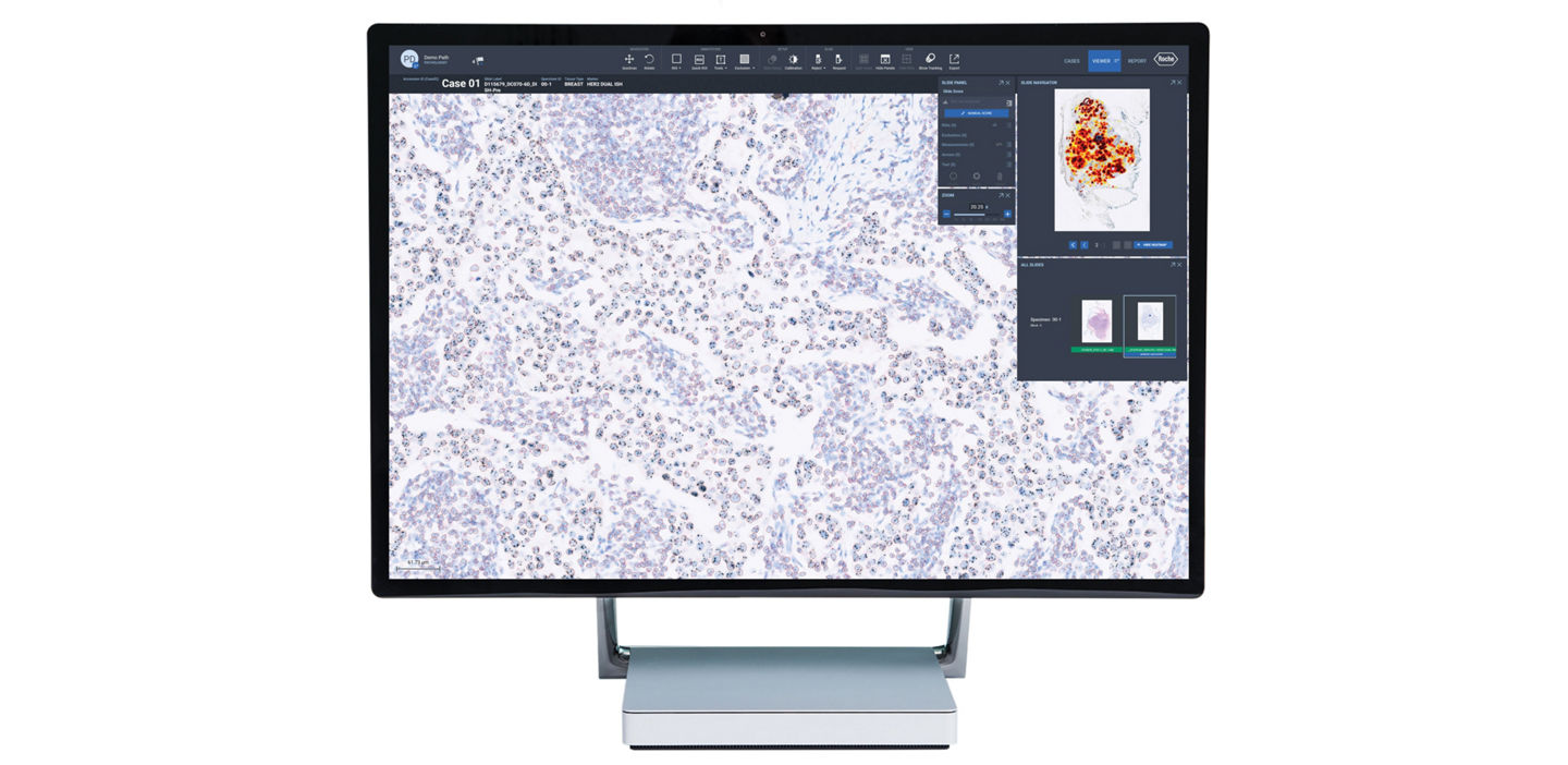 Roche uPath HER2 DISH 画像解析 (Breast用) アルゴリズムプレビュー