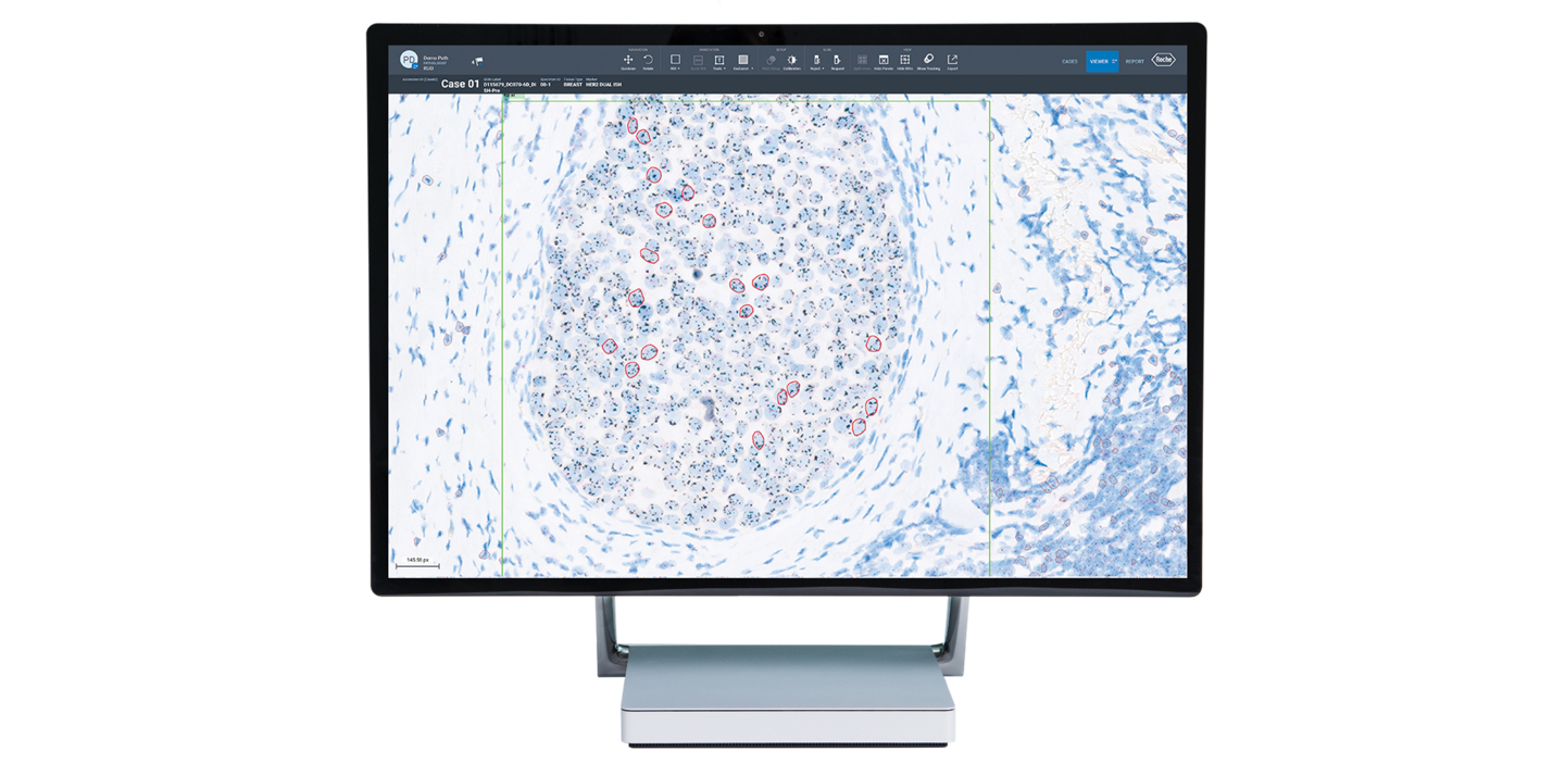 Moniteur de l’algorithme VENTANA HER2 Dual ISH