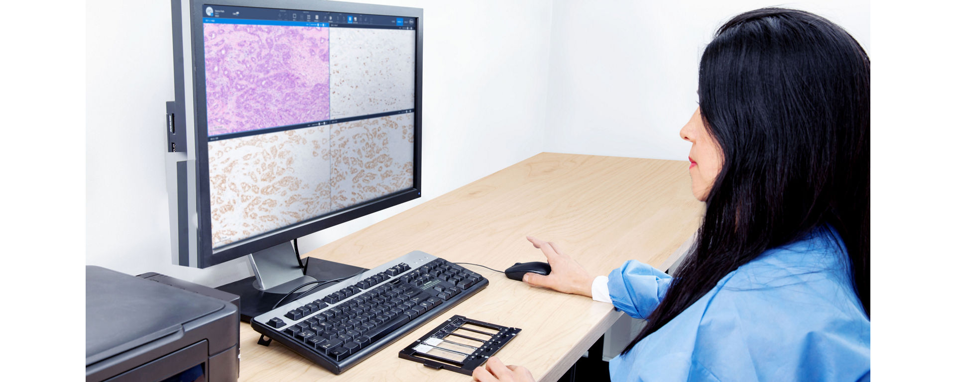 uPath PR (1E2) image analysis, Breast