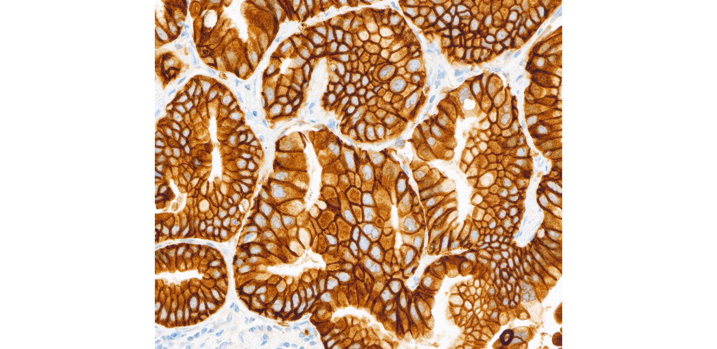 VENTANA® MET (SP44) RxDx Assay