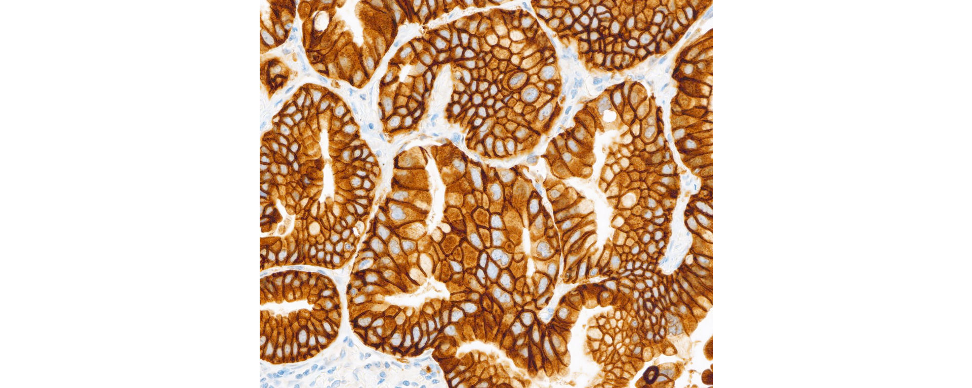 VENTANA® MET (SP44) RxDx Assay