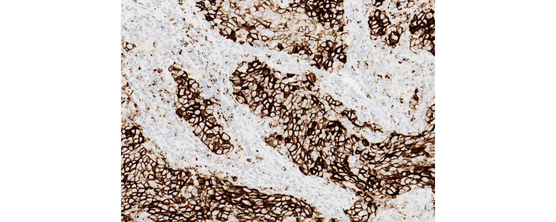 VENTANA PD-L1 SP142 IHC assay stain image